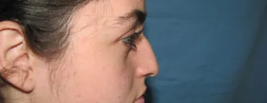 La imagen 2 de la Empresa OTORRINOLARINGOLOGO DR. LUMBAN Salud y Medicina en Tijuana BCN