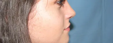 La imagen 3 de la Empresa OTORRINOLARINGOLOGO DR. LUMBAN Salud y Medicina en Tijuana BCN