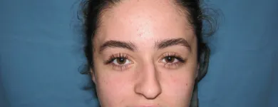 La imagen 4 de la Empresa OTORRINOLARINGOLOGO DR. LUMBAN Salud y Medicina en Tijuana BCN