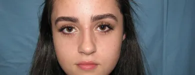 La imagen 5 de la Empresa OTORRINOLARINGOLOGO DR. LUMBAN Salud y Medicina en Tijuana BCN