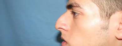 La imagen 6 de la Empresa OTORRINOLARINGOLOGO DR. LUMBAN Salud y Medicina en Tijuana BCN