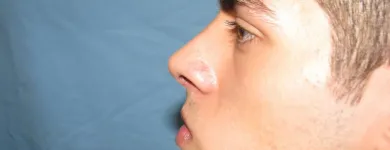 La imagen 7 de la Empresa OTORRINOLARINGOLOGO DR. LUMBAN Salud y Medicina en Tijuana BCN