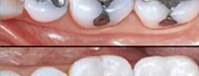 La imagen 2 de la Empresa WORLD SMILE Salud y Medicina en Ciudad Juárez CHH