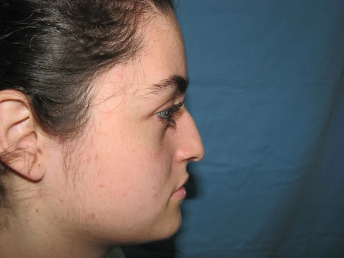 La imagen 2 de la Empresa OTORRINOLARINGOLOGO DR. LUMBAN