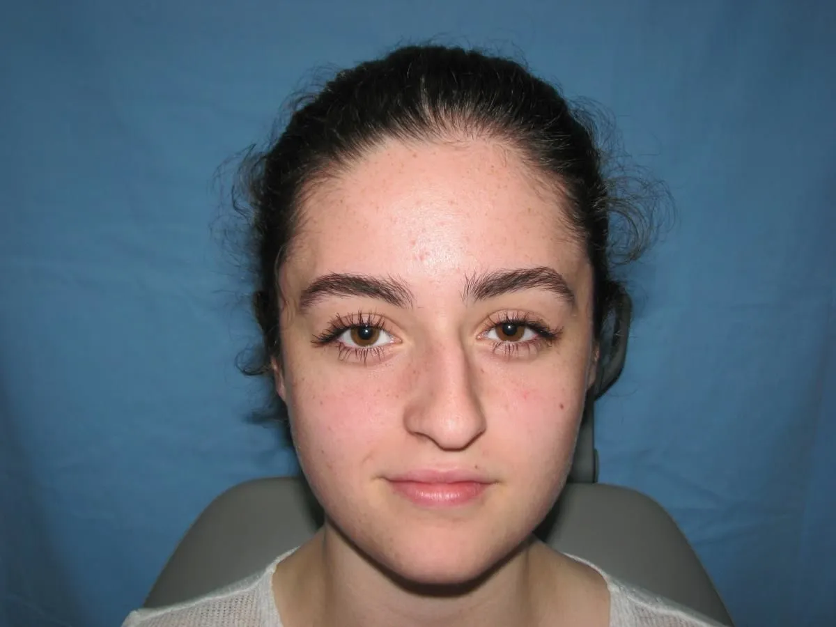 La imagen 4 de la Empresa OTORRINOLARINGOLOGO DR. LUMBAN