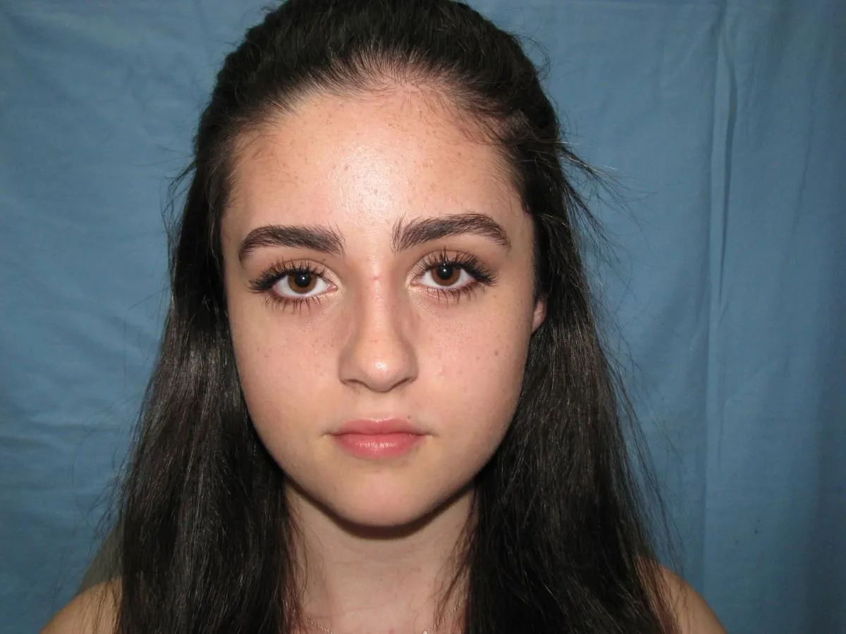 La imagen 5 de la Empresa OTORRINOLARINGOLOGO DR. LUMBAN