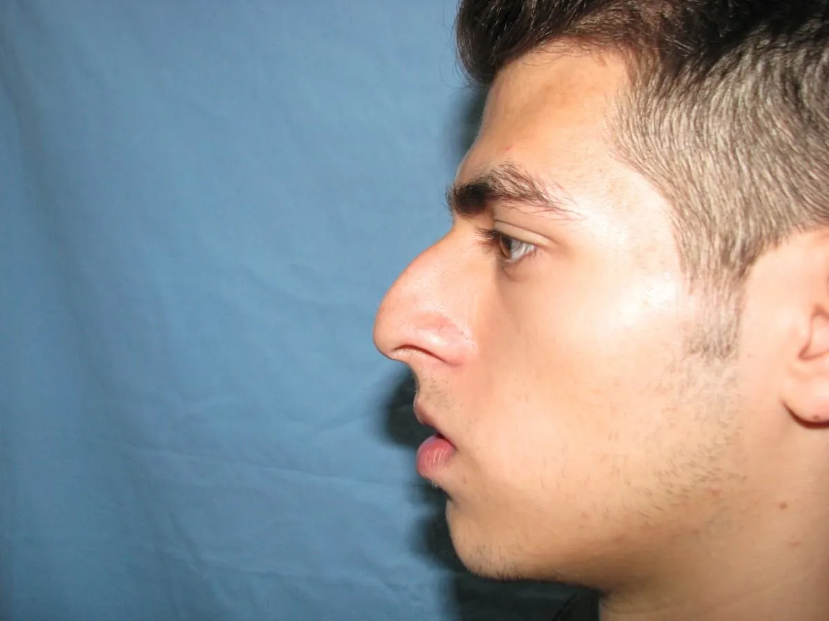 La imagen 6 de la Empresa OTORRINOLARINGOLOGO DR. LUMBAN