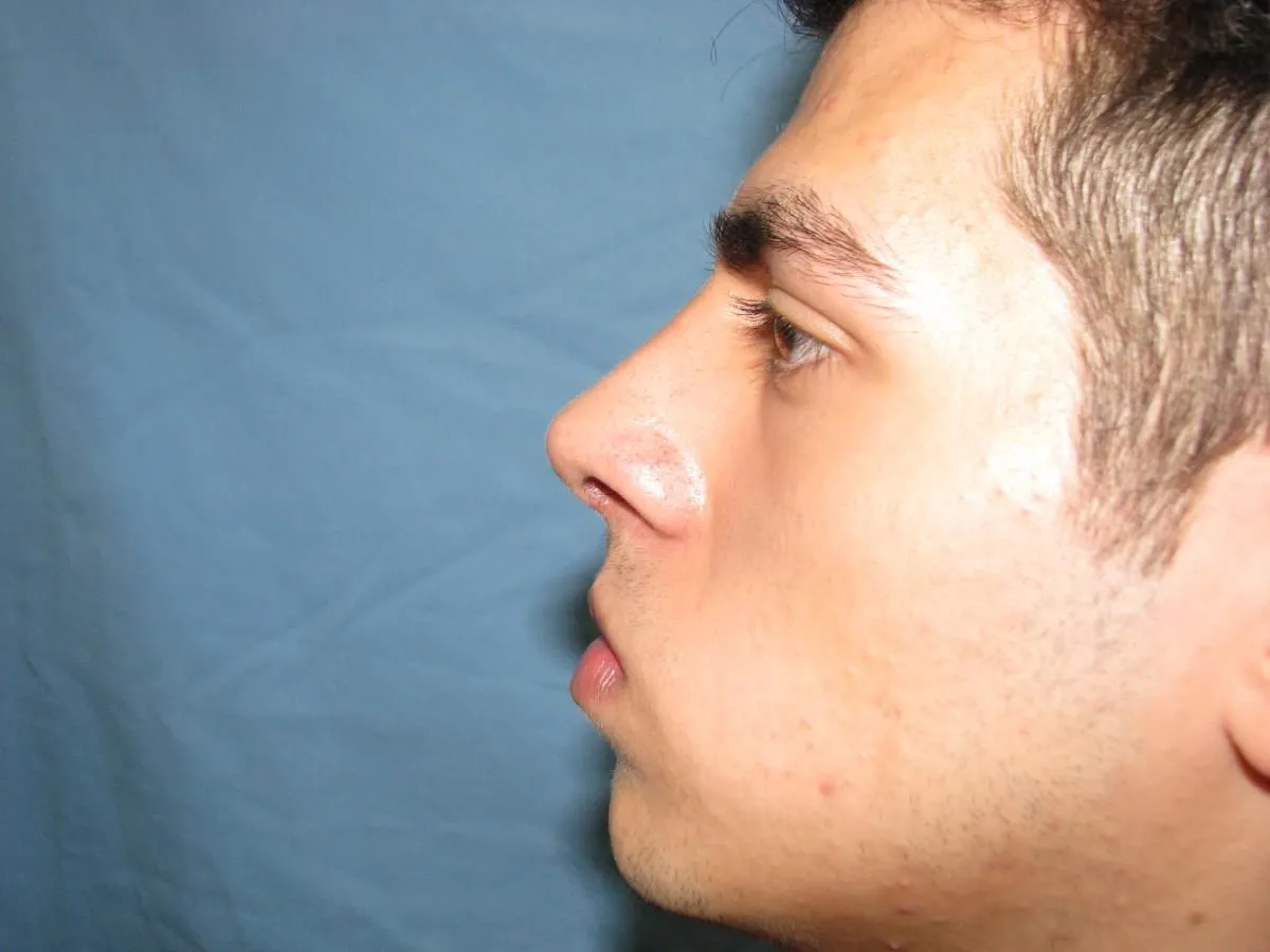 La imagen 7 de la Empresa OTORRINOLARINGOLOGO DR. LUMBAN