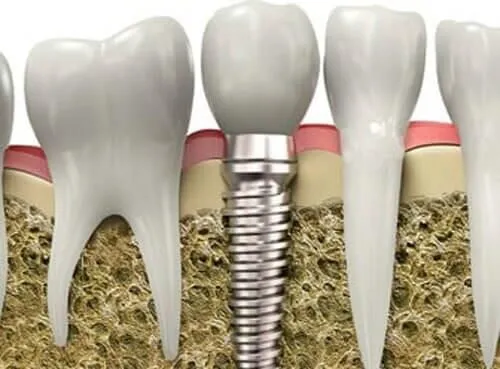 La imagen 1 de la Empresa WORLD SMILE