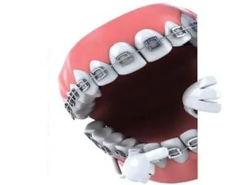 La imagen 3 de la Empresa WORLD SMILE